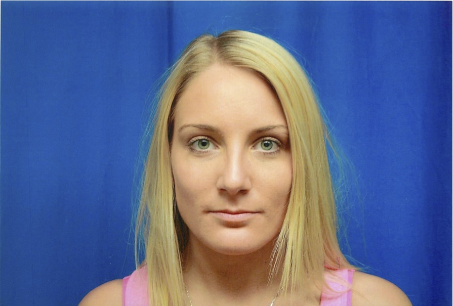 Front View After Rhinoplasty Surgery to Remove Bump in Nose, Left Side