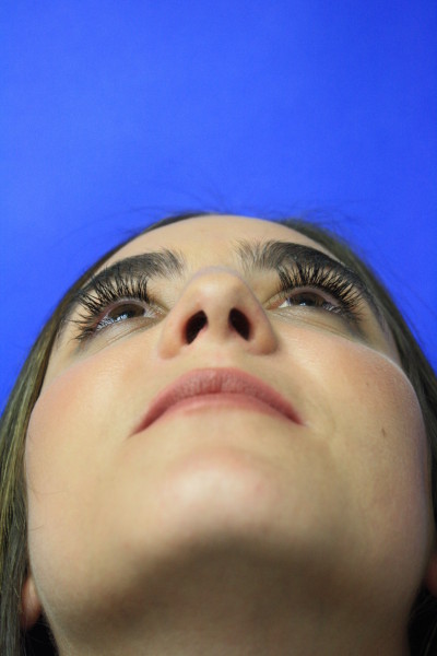 Looking Up View After Rhinoplasty Surgery