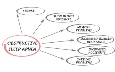 The Dangerous Side of Snoring – Obstructive Sleep Apnea