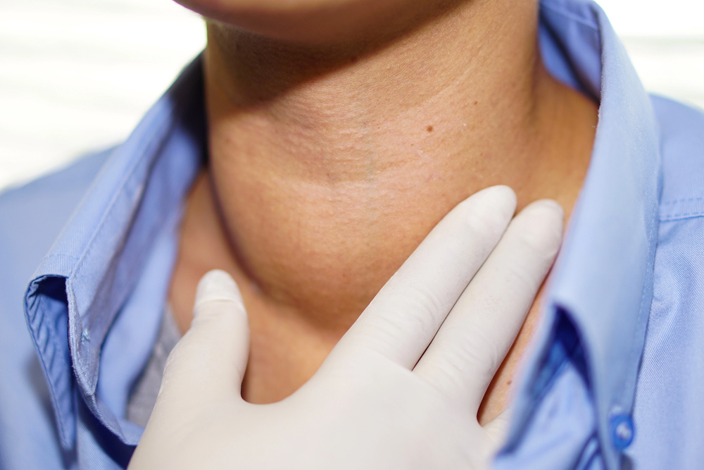 Neck Goiters vs. Thyroid Nodules: Risk Factors, Causes, and Treatment