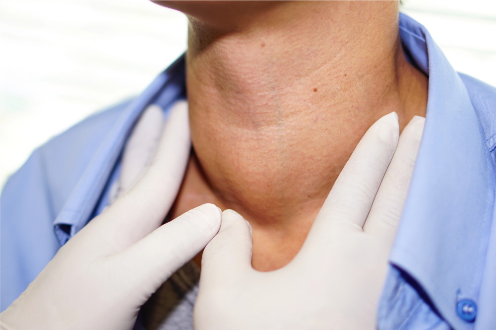 neck masses and neck cysts